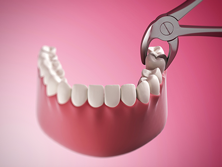Calogero Vassallo DDS, PLLC